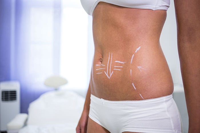 Body contouring and body surgery procedures by Dr. Haley Carpenter in Coral Springs, FL